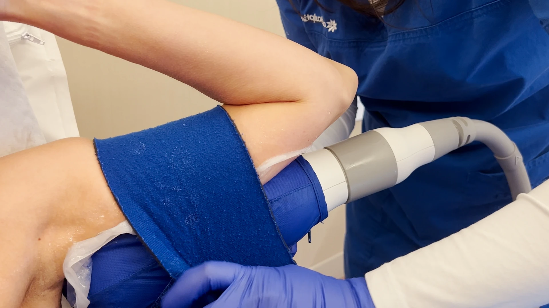 Eliminar Grasa Brazos con CoolSculpting
