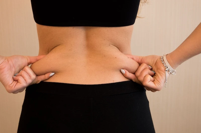 Grasa Localizada en Flancos: ¿Cómo eliminlarnos?