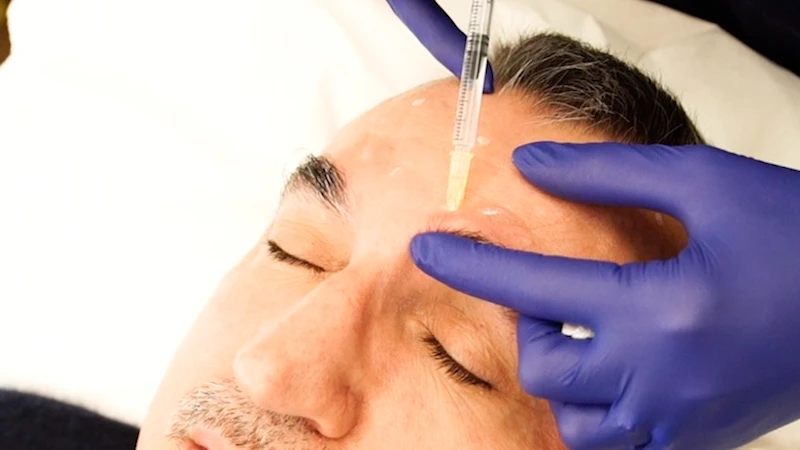 Tratamiento para Eliminar Arrugas en Frente y Entrecejo